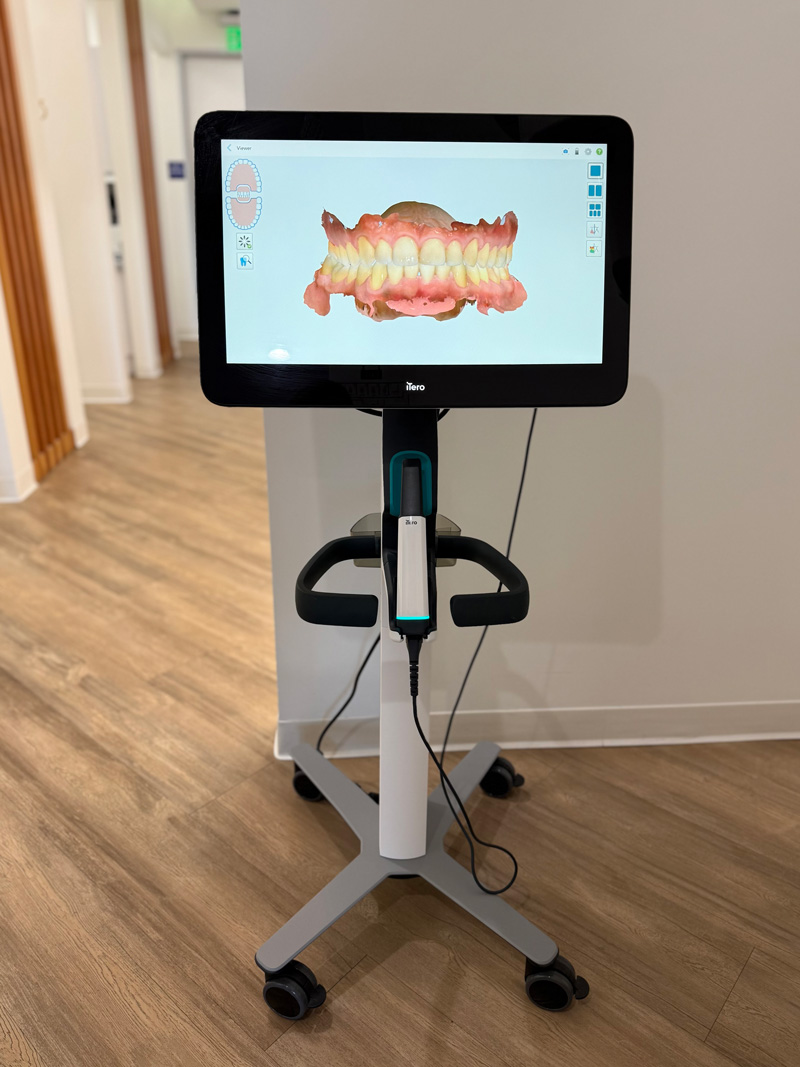 iTero Digital Scanner