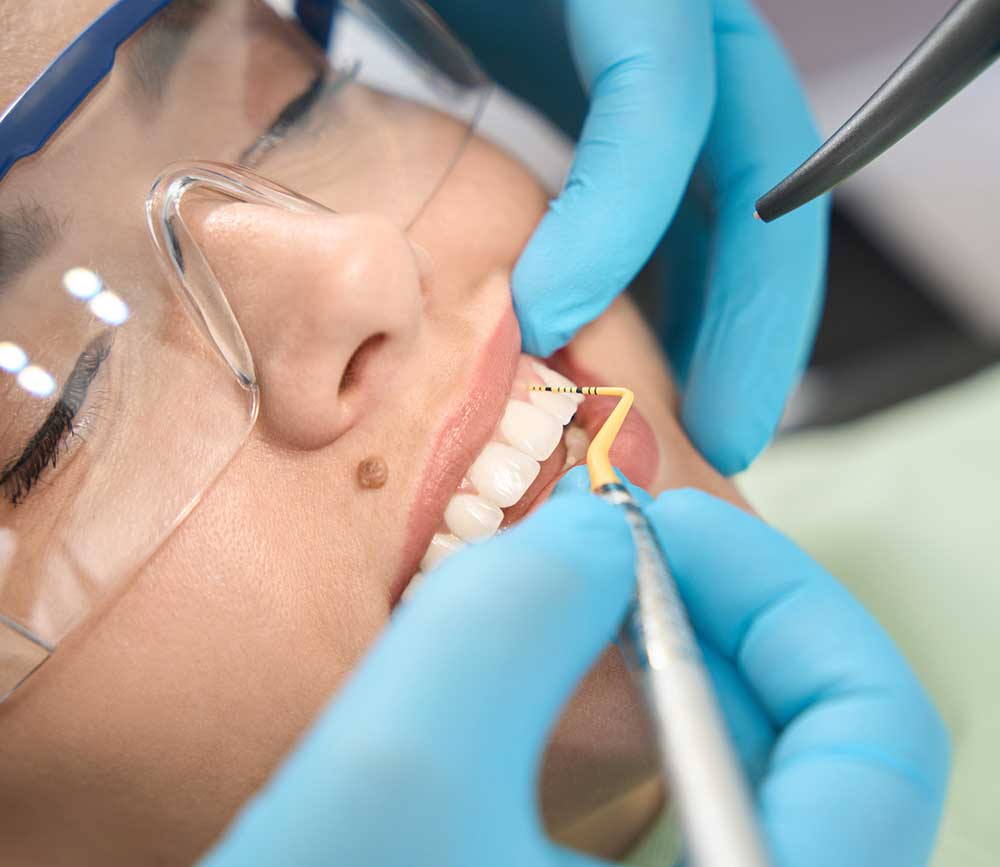 Restorative Dentistry