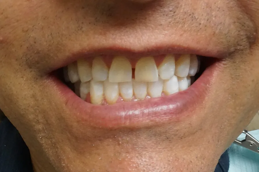 Alfredo Before Cropped (2)