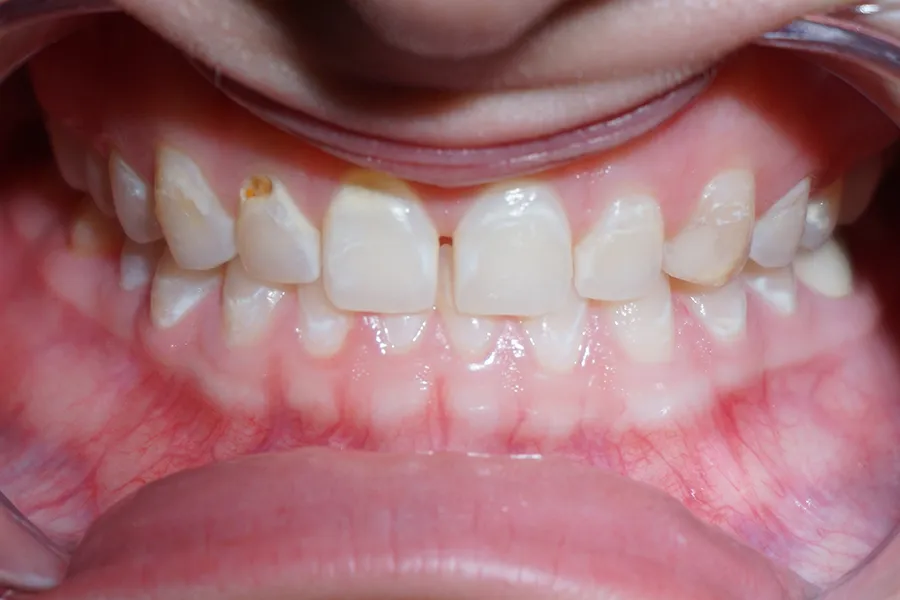 Micelle 2 Before Cropped