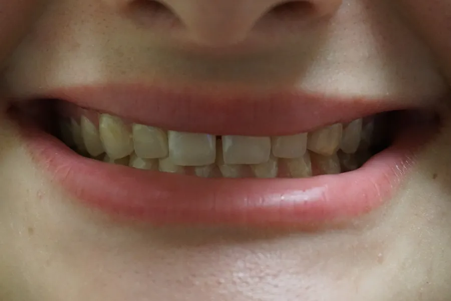 Micelle Before Cropped