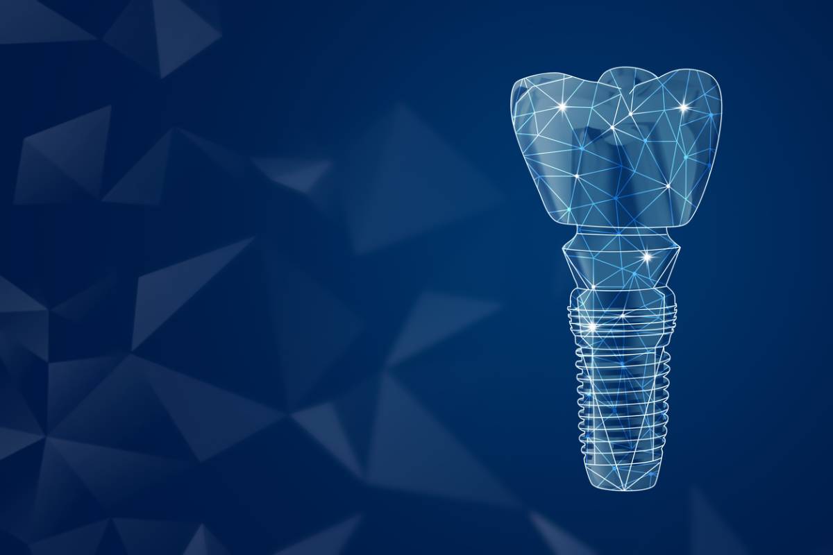Further Advancements in Dental Implants