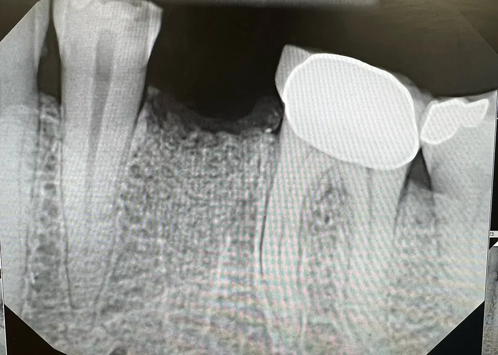 xray_after-image2 (4)